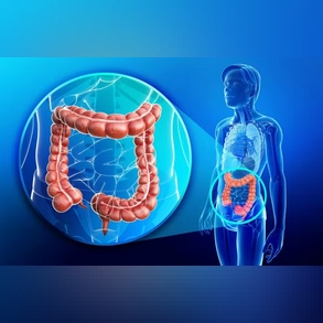 CÁNCER DE COLON